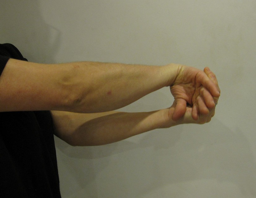Wrist Extensor Stretch  © Nina Leonfellner
