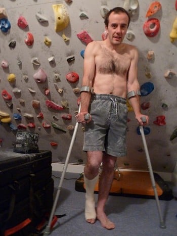 Dave MacLeod on crutches after being lowered off the end of the rope in 2012  © Dave MacLeod Collection