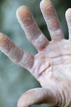 The sign of a soggy hand: pink tips, flappers and generally pretty shoddy skin  © Rob Greenwood - UKC