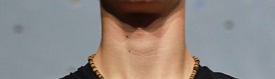 Who's neck?  © UKC Articles