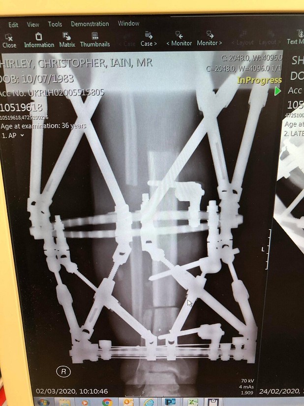 An X-ray featuring metalwork.  © Chris Shirley